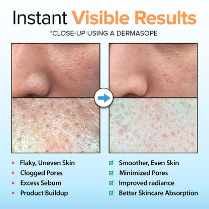 Ebanel Brightening Peeling Gel with Cotton Cellulose, Rice, Papaya, Centella, Hyaluronic Acid for Face and Body, Gentle Exfoliating Face Scrub Gel Peel Wash, Deep Pore Cleanser Minimizer Exfoliator - dailyvitalstore