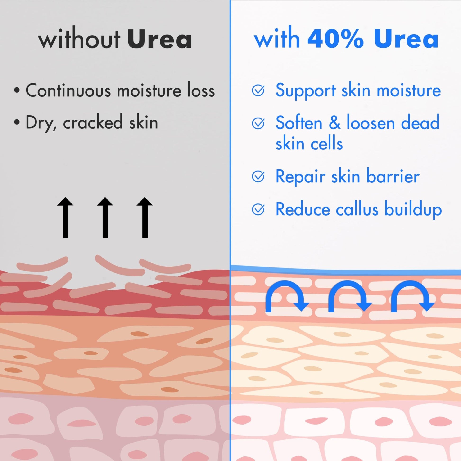 Ebanel Urea Cream 40% plus Salicylic Acid 2%, Foot Cream for Dry Cracked Heels Feet Knees Elbows Hands, Foot Dead Skin Cuticle Callus Remover Toenail Softener, Keratolytic Skin Barrier Repair, 2-Pack - dailyvitalstore