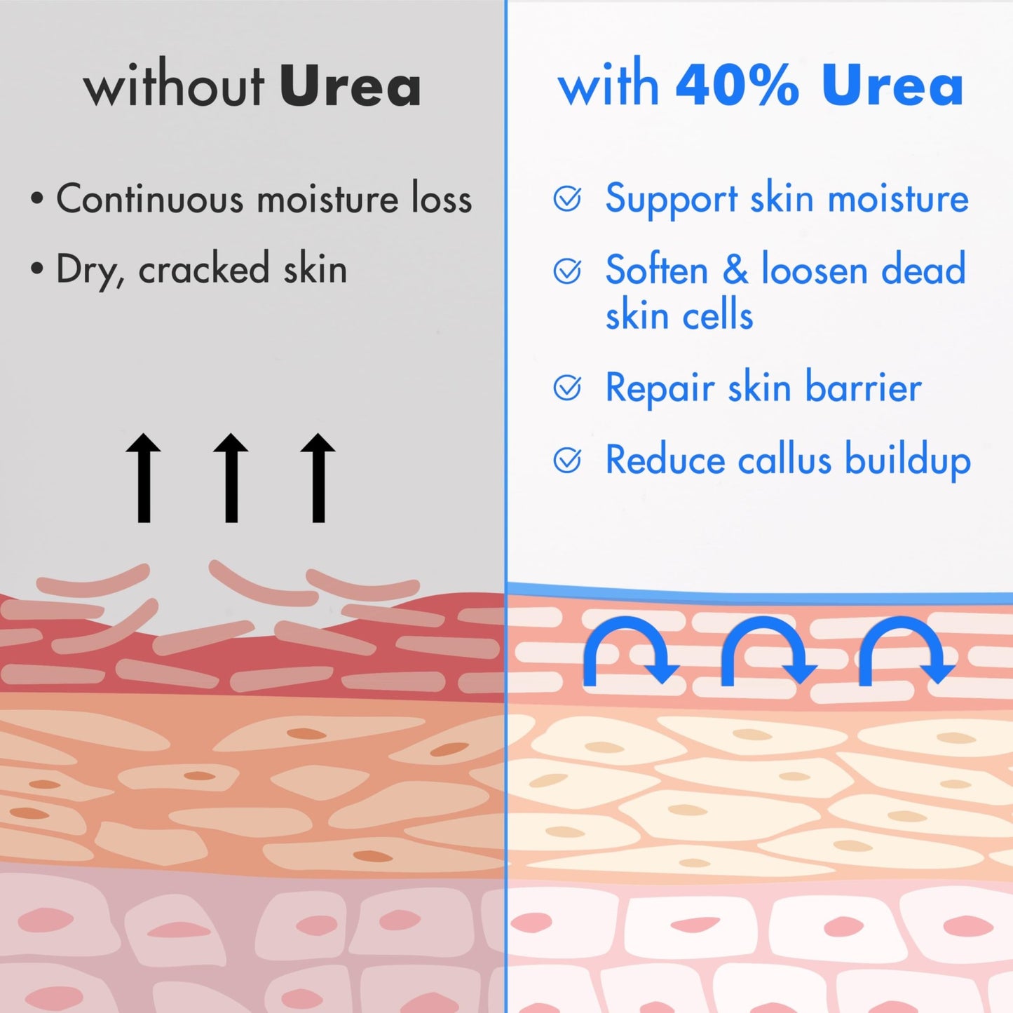 Ebanel Urea Cream 40% plus Salicylic Acid 2%, Foot Cream for Dry Cracked Heels Feet Knees Elbows Hands, Foot Dead Skin Cuticle Callus Remover Toenail Softener, Keratolytic Skin Barrier Repair, 3-Pack - dailyvitalstore