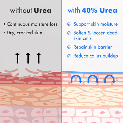 Ebanel Urea Cream 40% plus Salicylic Acid 2%, Foot Cream for Dry Cracked Heels Feet Knees Elbows Hands, Foot Dead Skin Cuticle Callus Remover Toenail Softener, Keratolytic Skin Barrier Repair, 3-Pack - dailyvitalstore