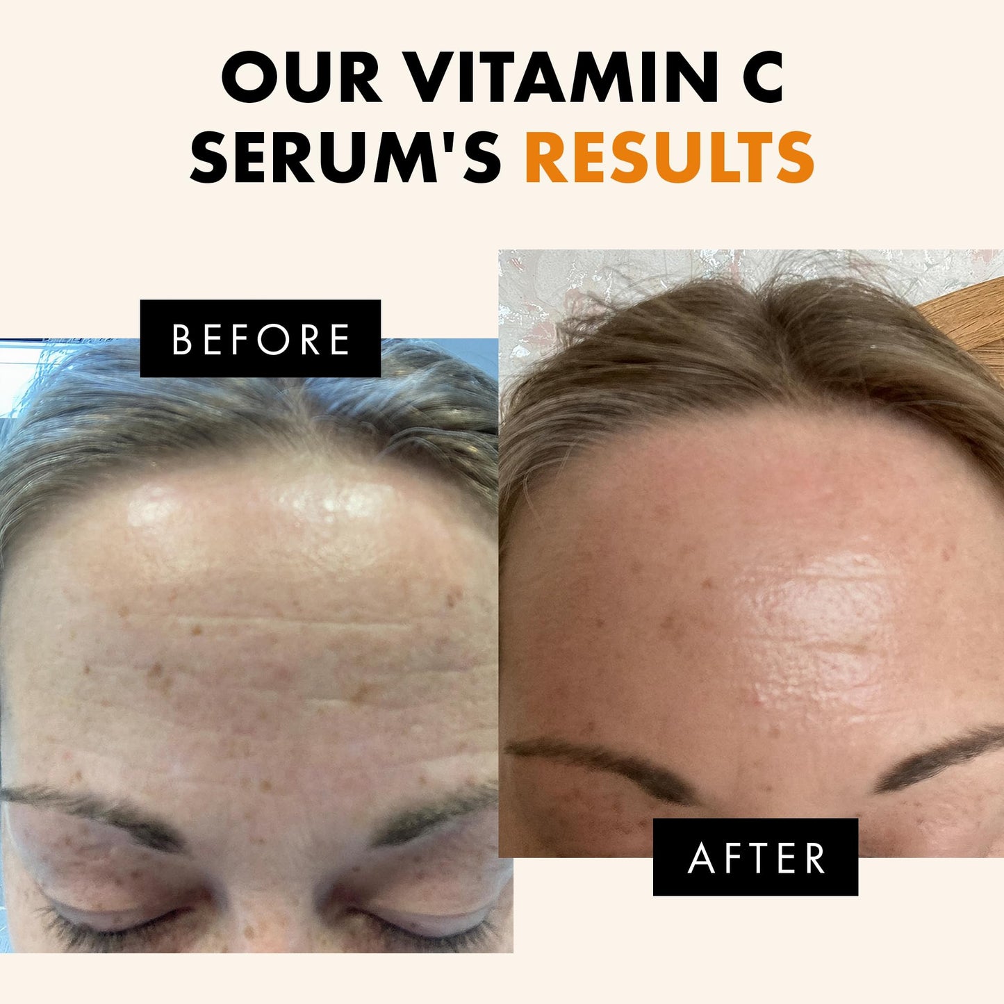 Eclat Skincare Vitamin C Serum - Skin Care for Dark Spots, Vitamin C Serum for Face with Hyaluronic Acid, Ferulic Acid, & Vit E - dailyvitalstore