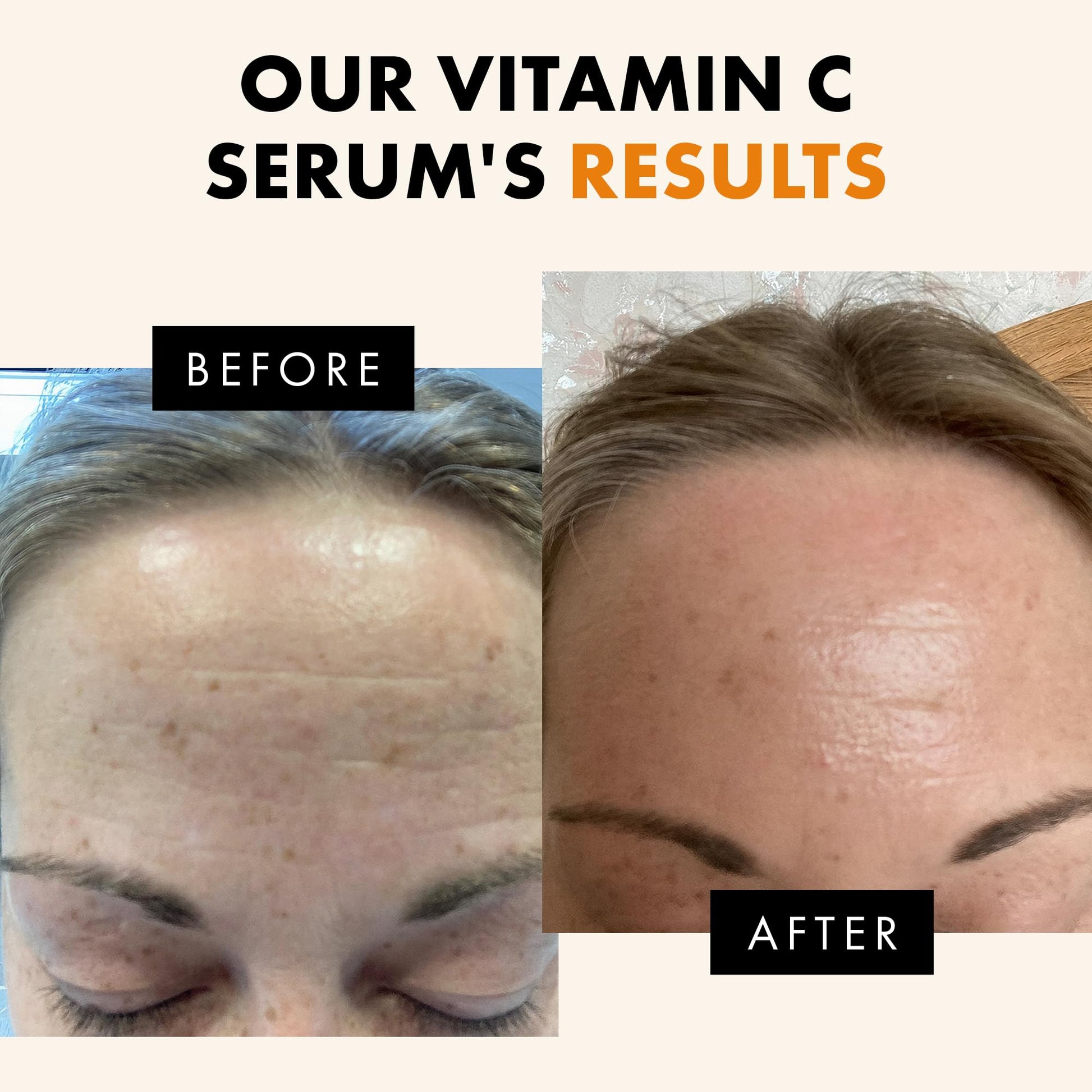 Eclat Skincare Vitamin C Serum - Skin Care for Dark Spots, Vitamin C Serum for Face with Hyaluronic Acid, Ferulic Acid, & Vit E - dailyvitalstore