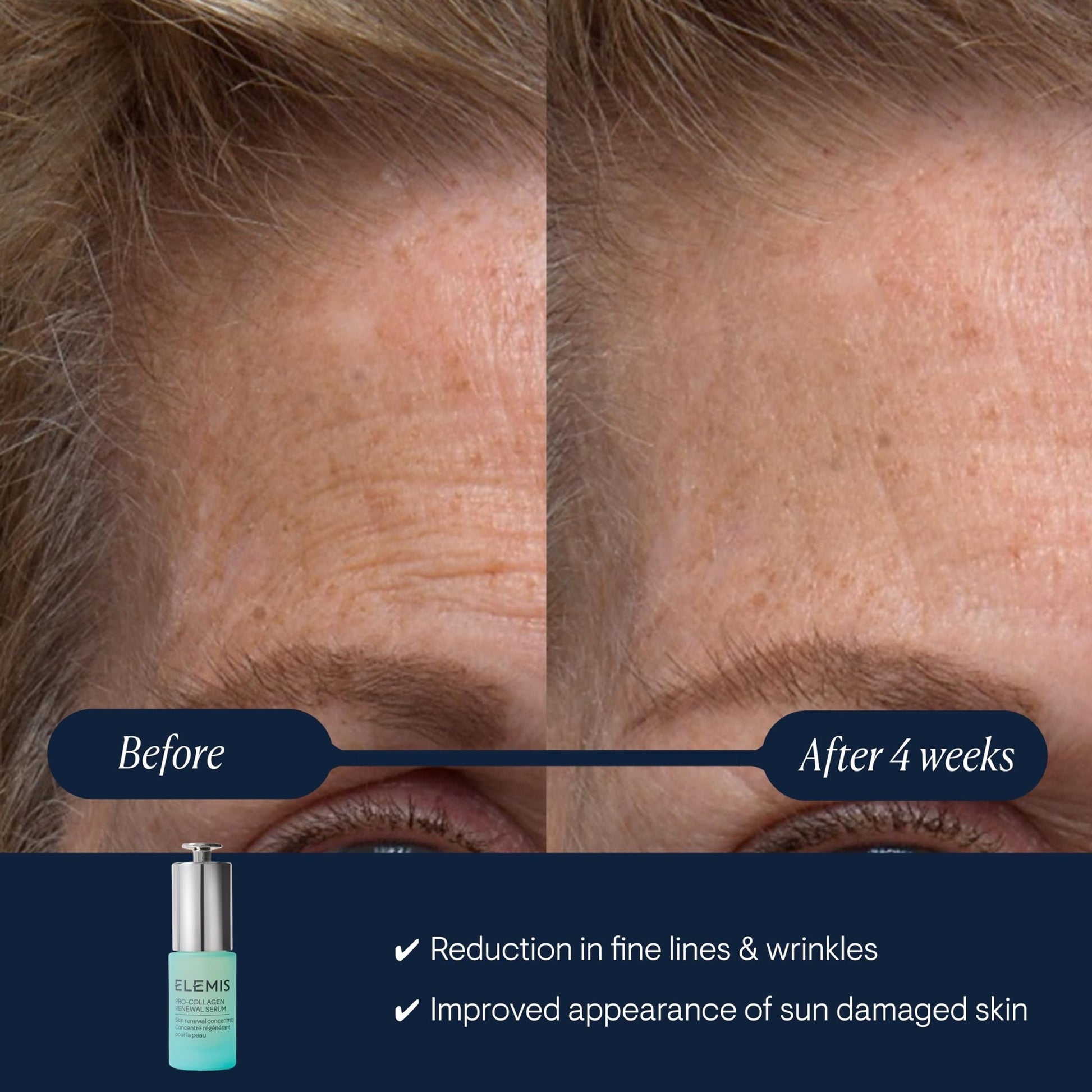 ELEMIS Pro-Collagen Renewal Serum 15ml, Gentle Retinol Alternative for Smoothing Fine Lines & Wrinkles - dailyvitalstore