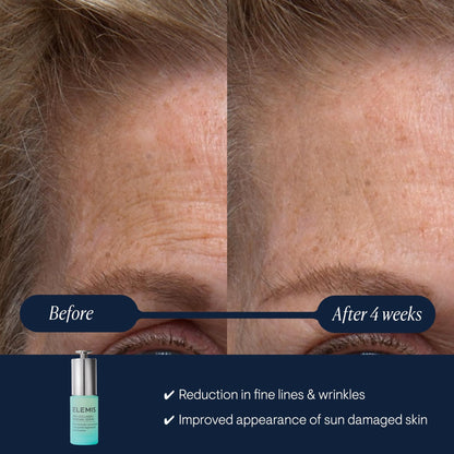 ELEMIS Pro-Collagen Renewal Serum 15ml, Gentle Retinol Alternative for Smoothing Fine Lines & Wrinkles - dailyvitalstore