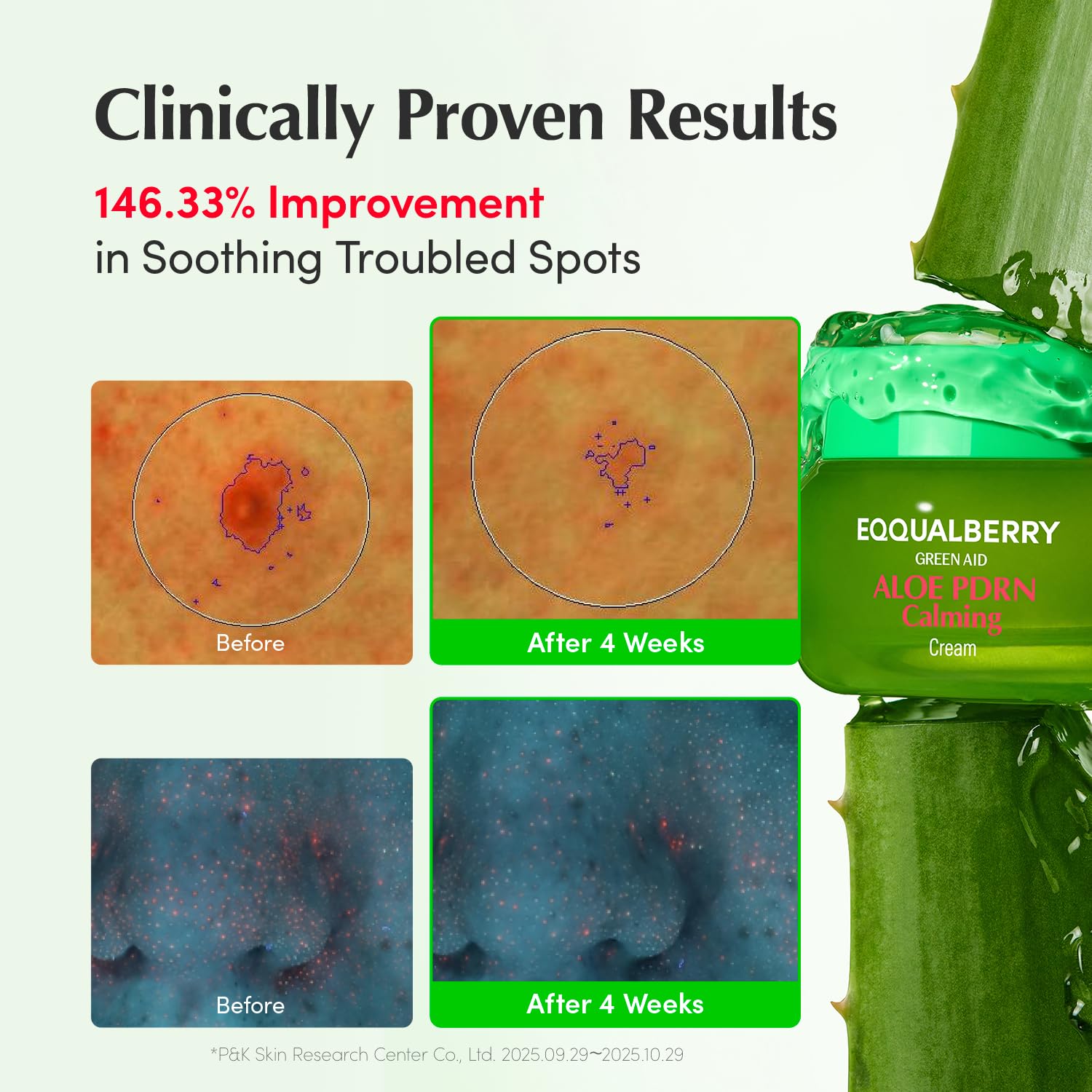 EQQUALBERRY ALOE PDRN Calming Cream | 7% Aloe PDRN & 10% Aloe Vera Water + 5-Cica | Cooling Gel Moisturizer for Oily Skin, Barrier Repair & Blemish Marks - dailyvitalstore
