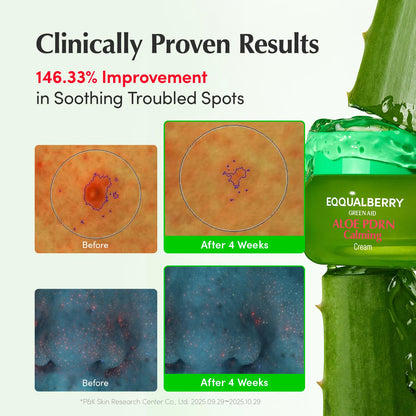 EQQUALBERRY ALOE PDRN Calming Cream | 7% Aloe PDRN & 10% Aloe Vera Water + 5-Cica | Cooling Gel Moisturizer for Oily Skin, Barrier Repair & Blemish Marks - dailyvitalstore