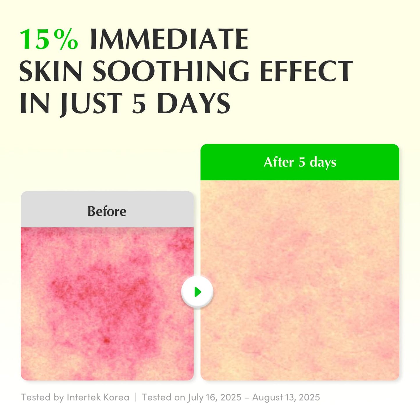 EQQUALBERRY Aloe PDRN Calming Smoothie Serum – Soothing Korean Skin Care for Sensitive Skin, Cica & Aloe for Repair, Hydrating & Radiant Glow - dailyvitalstore