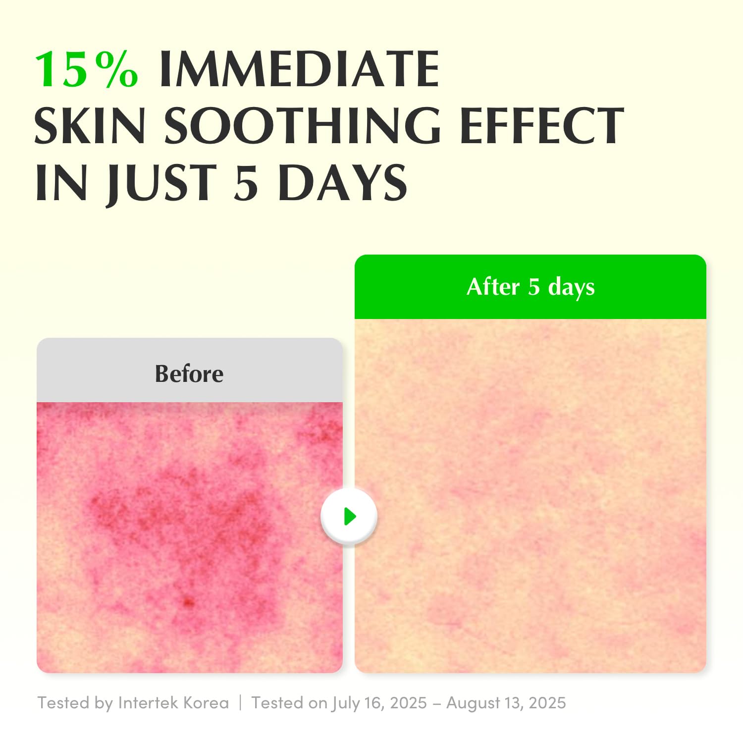 EQQUALBERRY Aloe PDRN Calming Smoothie Serum – Soothing Korean Skin Care for Sensitive Skin, Cica & Aloe for Repair, Hydrating & Radiant Glow - dailyvitalstore