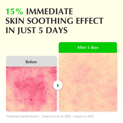 EQQUALBERRY Aloe PDRN Calming Smoothie Serum – Soothing Korean Skin Care for Sensitive Skin, Cica & Aloe for Repair, Hydrating & Radiant Glow - dailyvitalstore