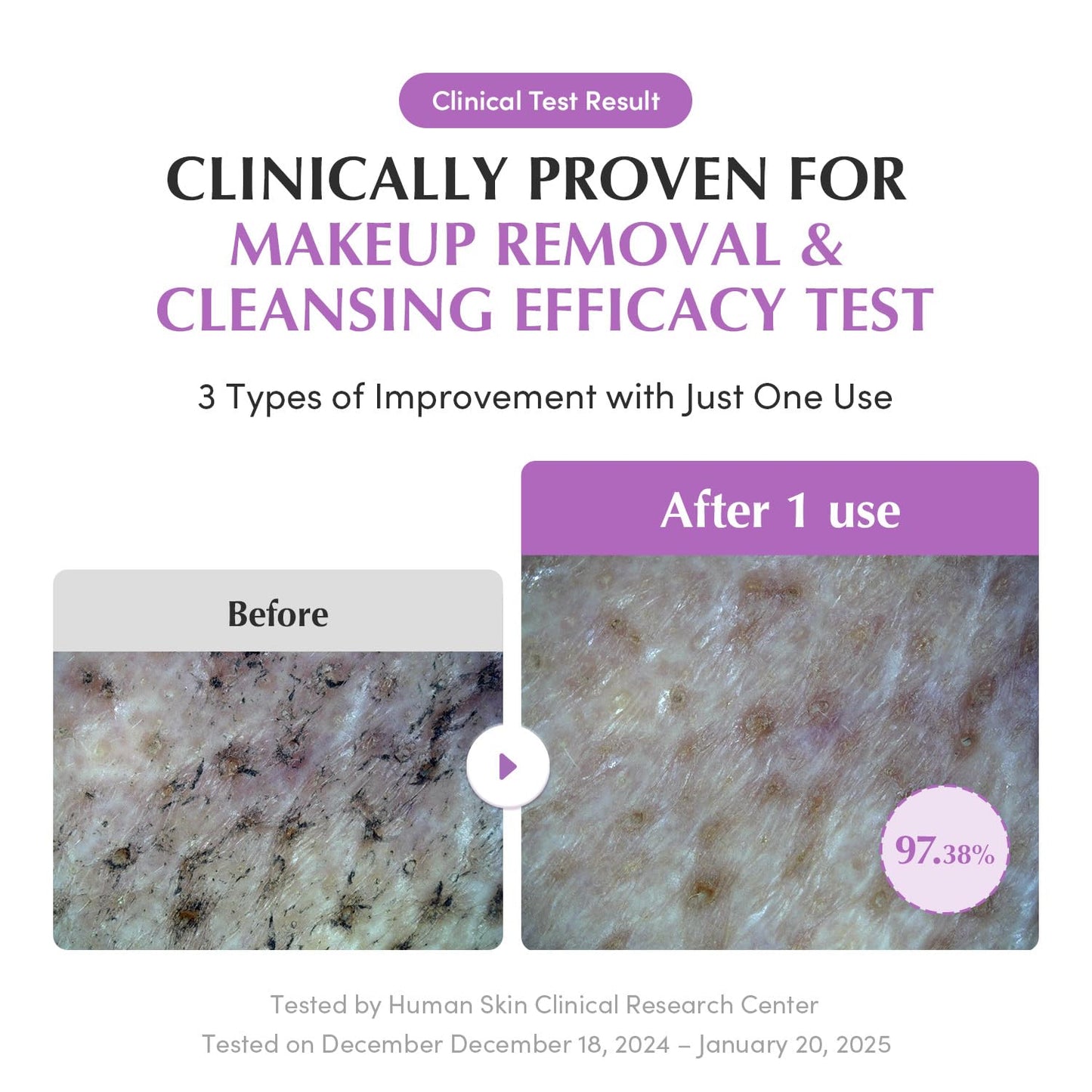 EQQUALBERRY Double Cleanser Duo for Facial Cleansing: Purple Rice Pore Cleansing Oil & Pack Cleanser – Removes Makeup, Blackheads & Impurities - dailyvitalstore