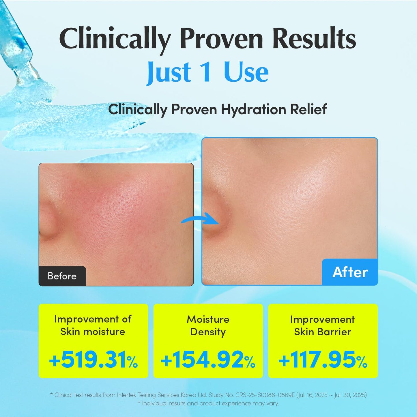 EQQUALBERRY Hyaltoin Flooding Smoothie Serum | 5% Hyaluronic Acid Serum for Face & Redness Relief | Deep Hydrating Cooling Care with 5 Ceramides - dailyvitalstore