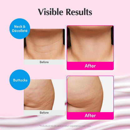 EQQUALBERRY NAD+ Peptide Boosting Cream Double Pack | NAD+ 5% & 13 Peptides Anti-Aging Korean Skincare Face & Body Cream | Firming & Lifting Pink Neck Cream - dailyvitalstore