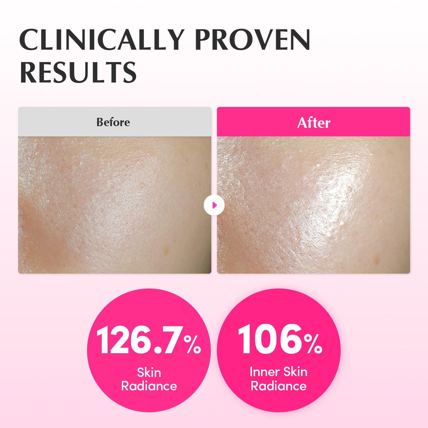 EQQUALBERRY NAD+ Peptide Boosting Toner – NAD+ 5% & 13 Peptides Anti-Aging Korean Skincare Hydrating Face Toner | Firming & Lifting Pink NAD - dailyvitalstore