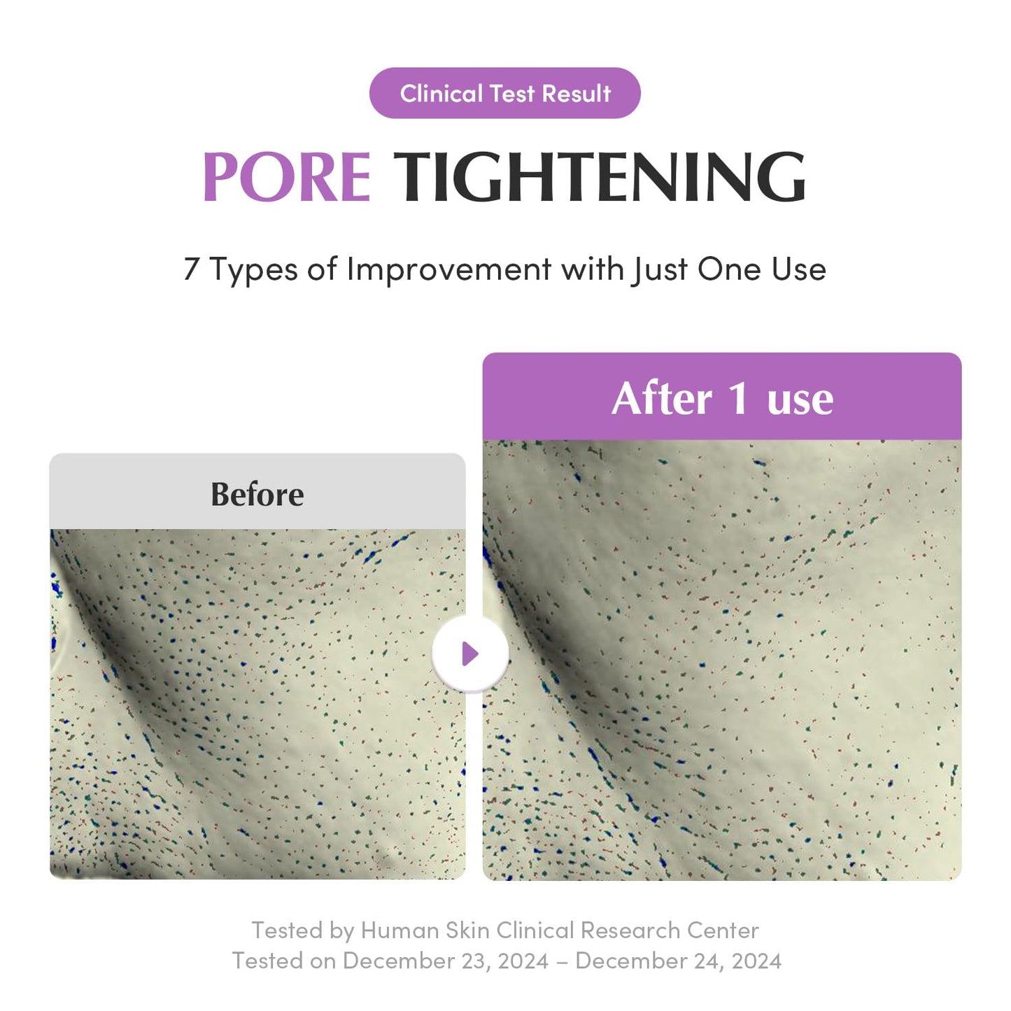EQQUALBERRY Purple Rice Pore Purifying Pack Cleanser - Dual-Use Clay Mask & Foam Cleanser | Deep Cleansing for Pore Care & Skin Prep | AHA+BHA+PHA - dailyvitalstore