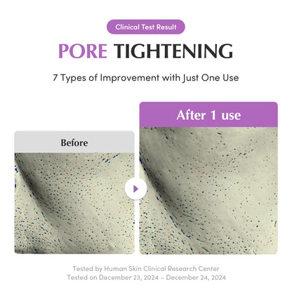 EQQUALBERRY Purple Rice Pore Purifying Pack Cleanser - Dual-Use Clay Mask & Foam Cleanser | Deep Cleansing for Pore Care & Skin Prep | AHA+BHA+PHA - dailyvitalstore