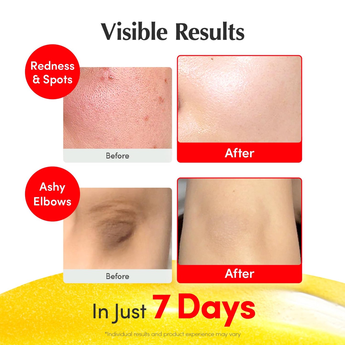 EQQUALBERRY Vitamin Illuminating Serum Double Pack | Niacinamide 4% & TXA | Brightening Vitamin C Serum for Glow & Hyaluronic Acid | Dark Spot & Uneven Tone Care - dailyvitalstore