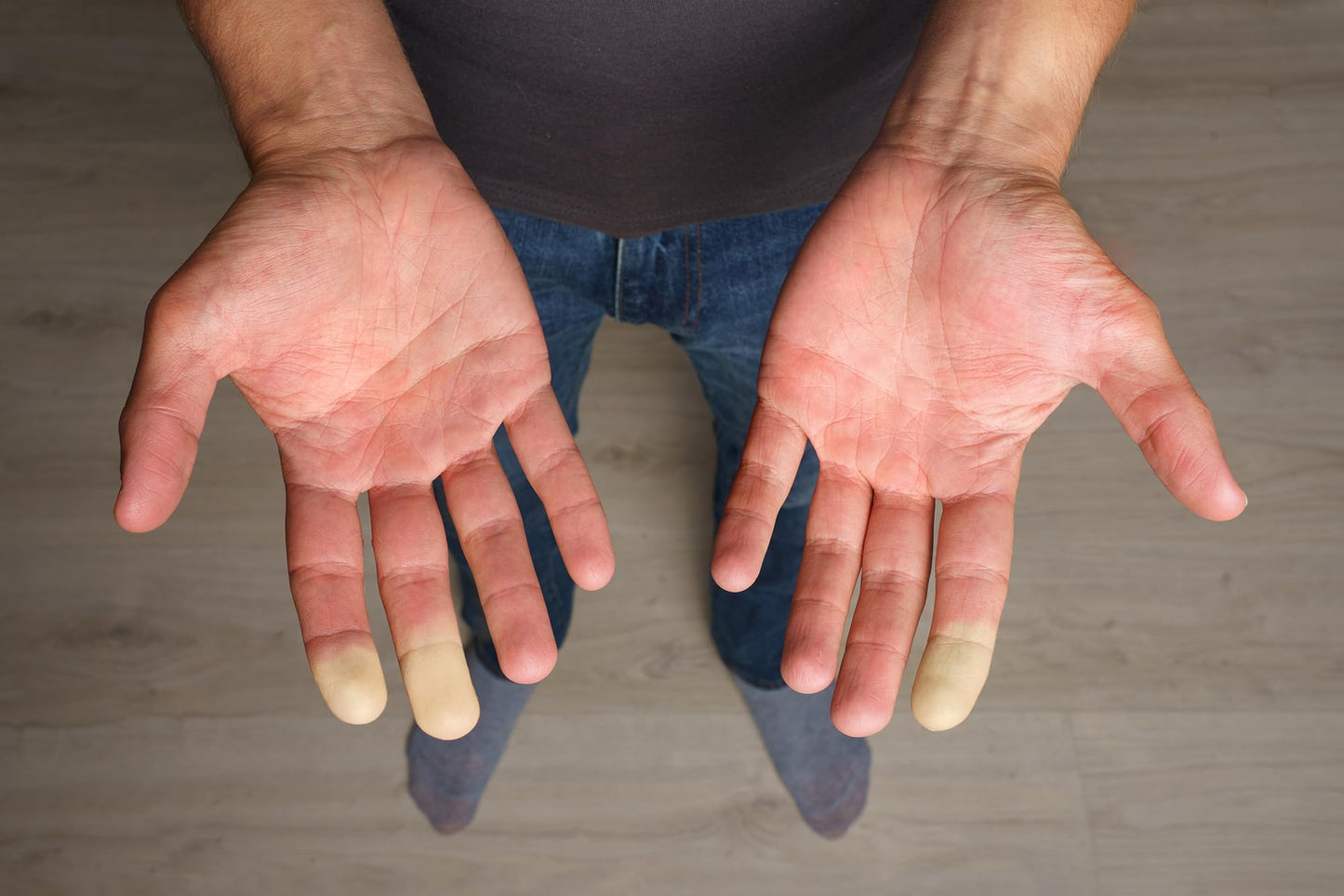 Extremity Warmth - for Cold Hands and Feet - dailyvitalstore