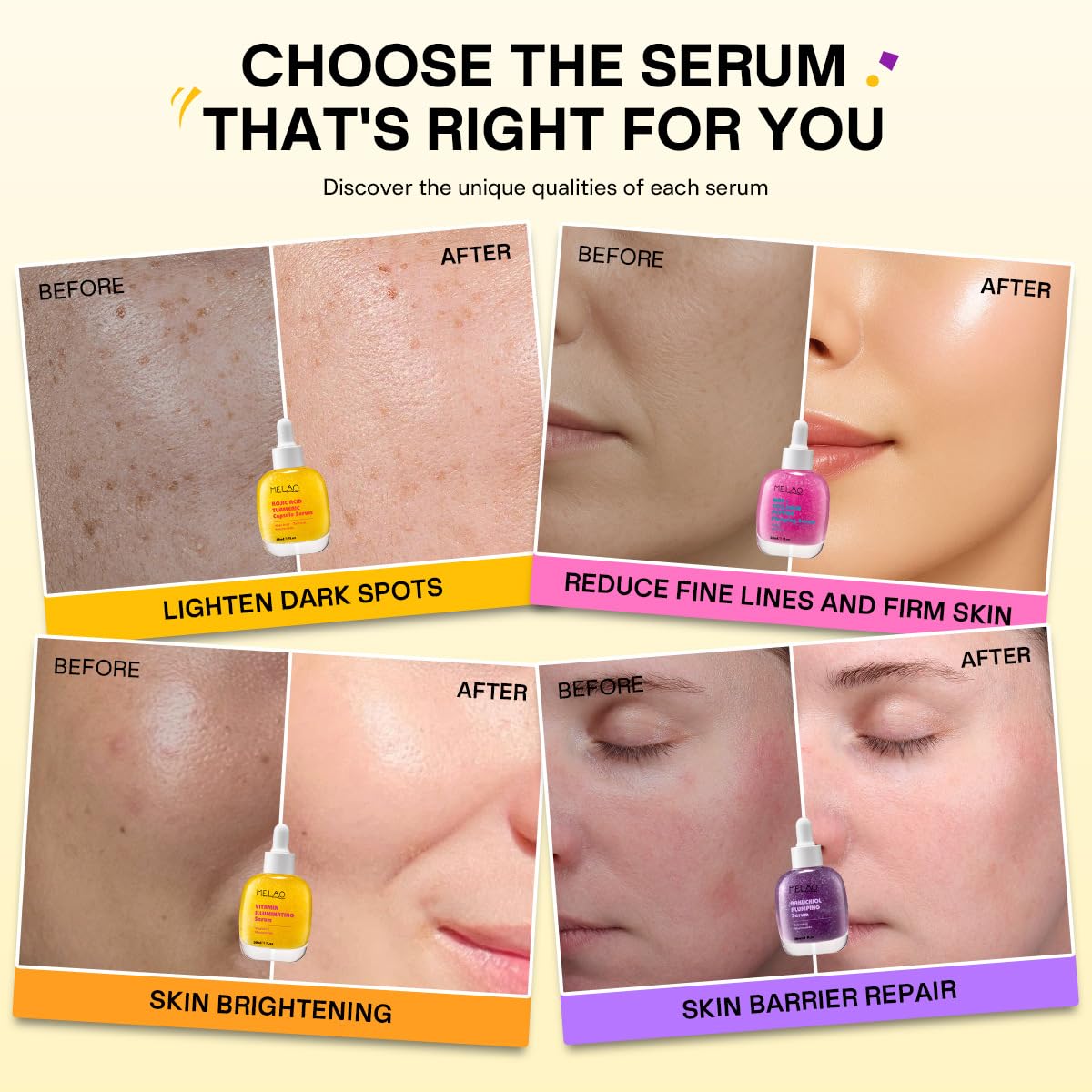 Face Serum with Niacinamide 4% | Vitamin C, Bakuchiol, NAD+ Collagen Peptide, Kojic Acid Turmeric Options | Korean Skincare for Brightening, Anti-Aging & Hydrating - dailyvitalstore
