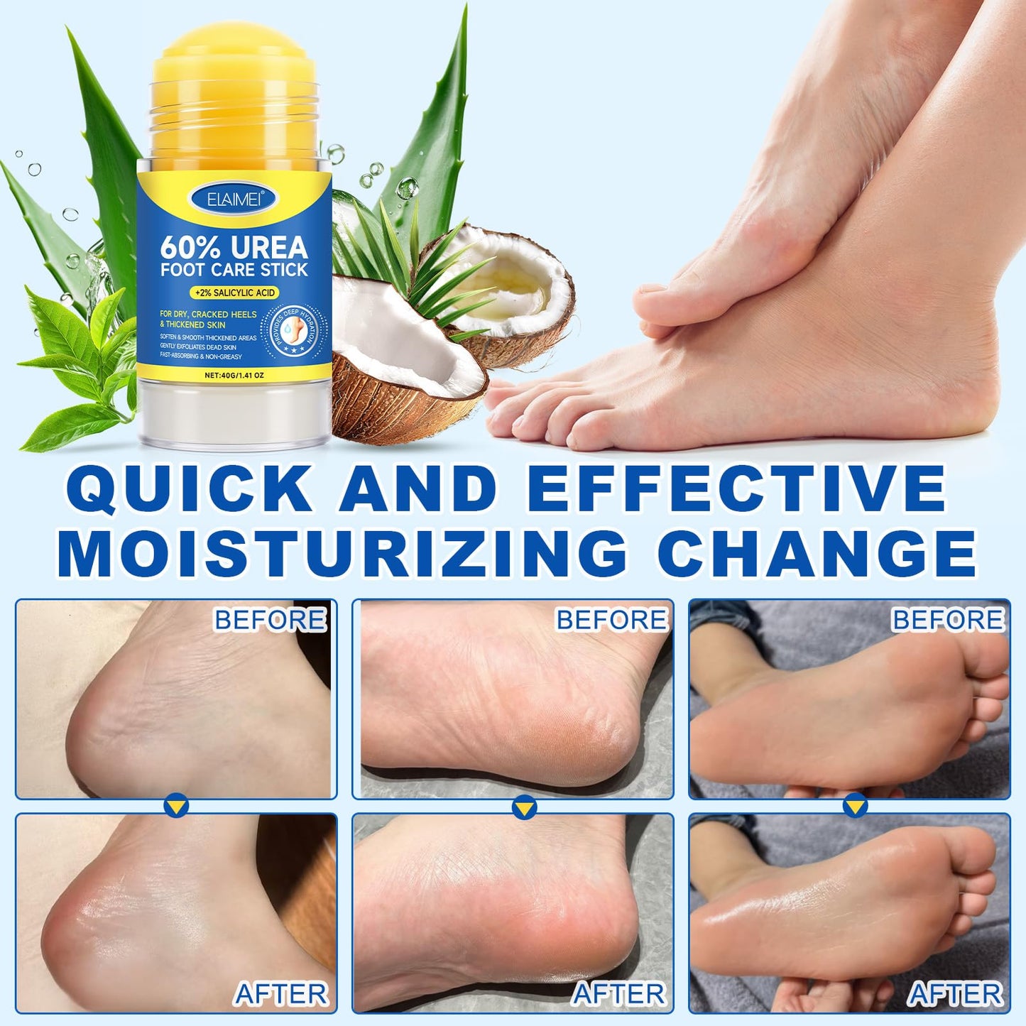 FANSHI 2 PCS Urea Stick 60% High Potency, Foot Care Urea Stick for Deeply Moisturizing & Fast Absorbing, Exfoliation for Dry Cracked Heels & Thickened Skin - dailyvitalstore