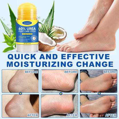 FANSHI 2 PCS Urea Stick 60% High Potency, Foot Care Urea Stick for Deeply Moisturizing & Fast Absorbing, Exfoliation for Dry Cracked Heels & Thickened Skin - dailyvitalstore