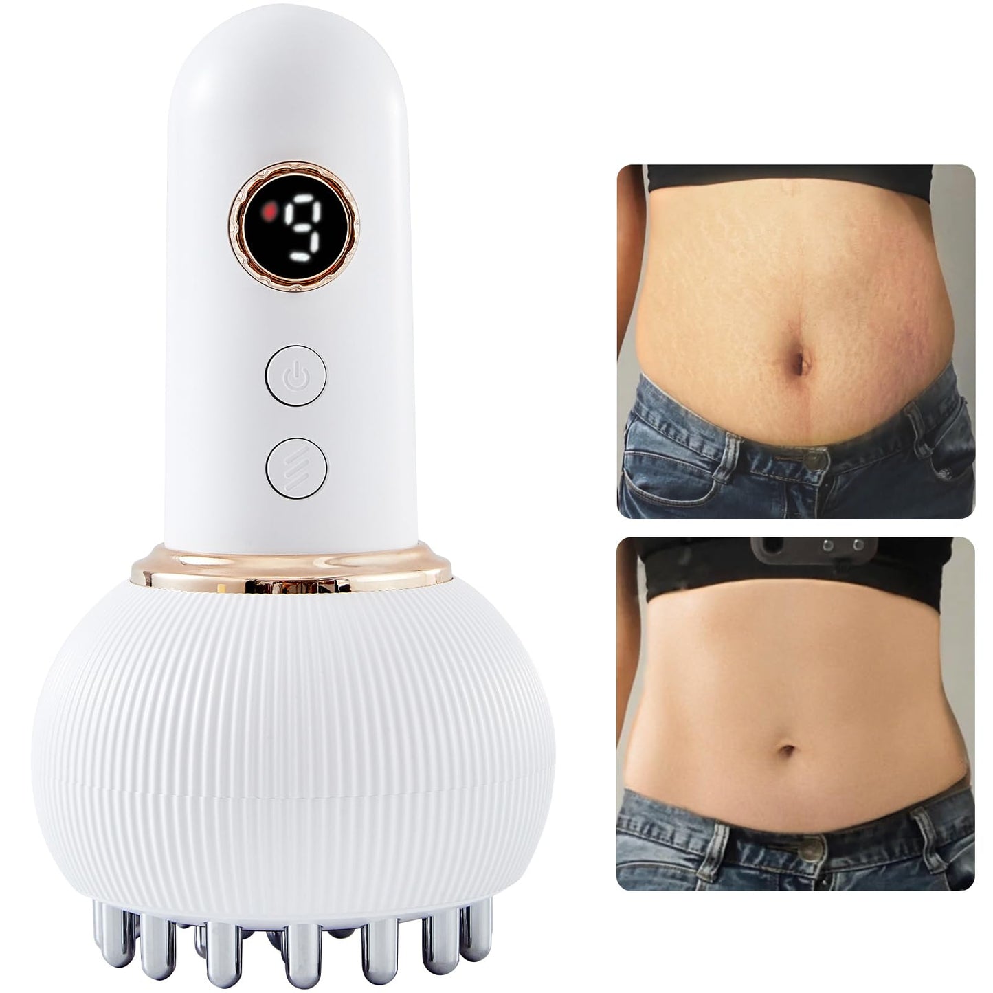 FEEOLA Lymphatic Drainage Massager & Cellulite Massage Tool, Helps Reduce Stretch Marks & Cellulite, for Legs, Arms & Belly, Body Sculpting Machine with Microcurrent, Light, Heat & Vibration - dailyvitalstore