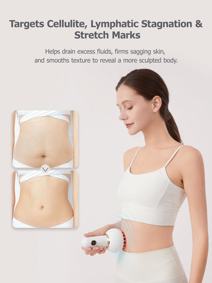 FEEOLA Lymphatic Drainage Massager & Cellulite Massage Tool, Helps Reduce Stretch Marks & Cellulite, for Legs, Arms & Belly, Body Sculpting Machine with Microcurrent, Light, Heat & Vibration - dailyvitalstore