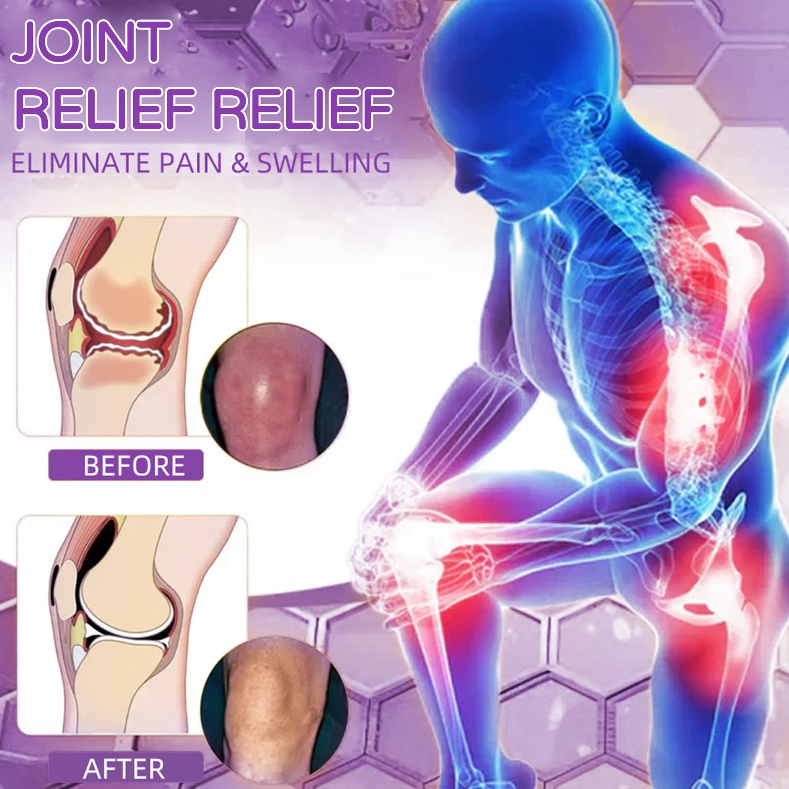 Flexbalm Rapid Joint Relief Therapy Gel 2.0, 2026 New Professional Relief Soothing Massage Gel, Flexbalm Rapid Joint Relief Cream for Back, Knee, Hands, Neck, Feet, for All Skin Types (2 Bottle) - dailyvitalstore