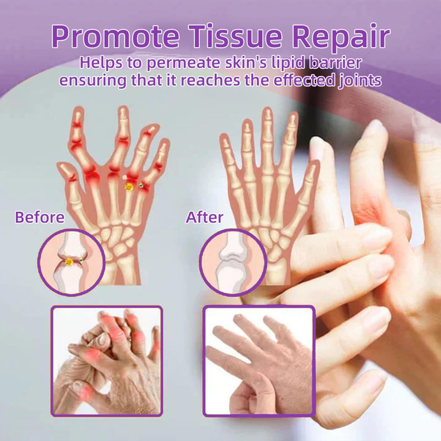 Flexbalm Rapid Joint Relief Therapy Gel 2.0, 2026 New Professional Relief Soothing Massage Gel, Flexbalm Rapid Joint Relief Cream for Back, Knee, Hands, Neck, Feet, for All Skin Types (2 Bottle) - dailyvitalstore