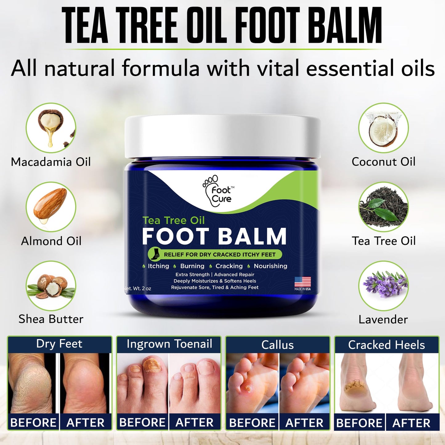 FOOT CURE Tea Tree Oil Balm – Moisturizer for Dry Cracked Feet – Instantly Hydrates & Soothes Irritated Skin & Athlete's Foot – Best Foot Care for Women and Men (Pack of 2) - dailyvitalstore