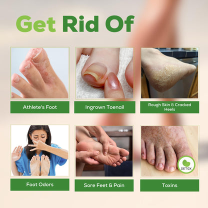 FOOT CURE Tea Tree Oil Foot Soak with Epsom Salt - Best Toenail Fungus Treatment, Athletes Foot & Softens Calluses - Soothes Sore & Tired Feet, Fungal Toe, Foot Odor Scent, Spa Pedicure (Pack of 2) - dailyvitalstore