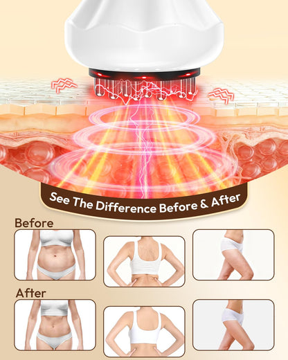 Glamesty Lymphatic Drainage Massager & Anti Cellulite Massage Tool, Body Sculpting Machine with Light, Soothing Pulse, Heat & Vibration, Heated Lymph Brush for Legs, Hip, Arms, Belly (White) - dailyvitalstore