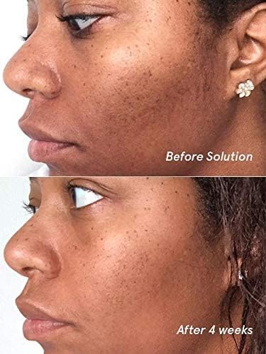 Glossier Solution exfoliating skin perfector 4.4 fl oz / 130 ml - dailyvitalstore