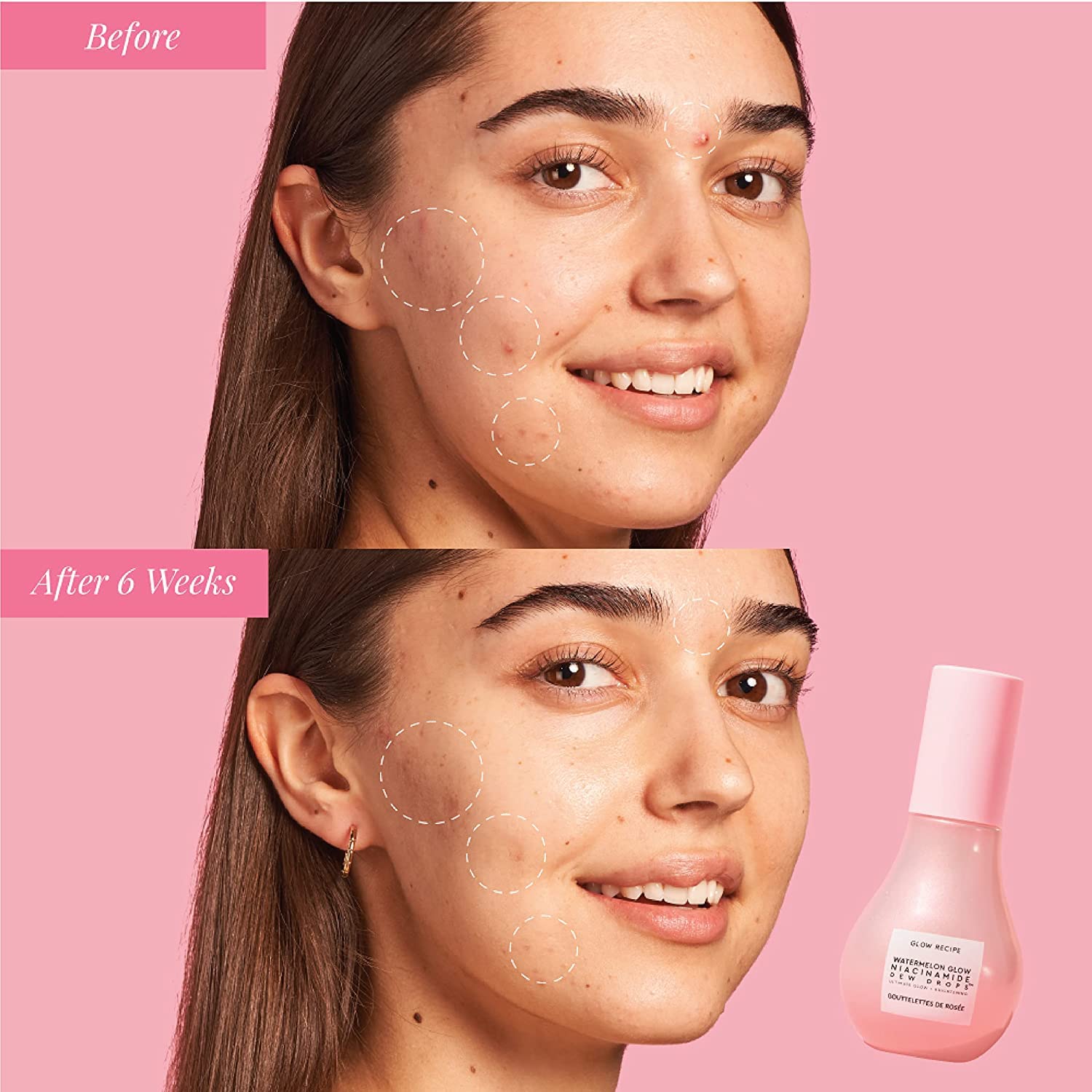 Glow Recipe Watermelon Niacinamide Dew Drops, Korean Niacinamide Serum Drops, Hydrating Face Serum + Primer & Liquid Highlighter, - dailyvitalstore