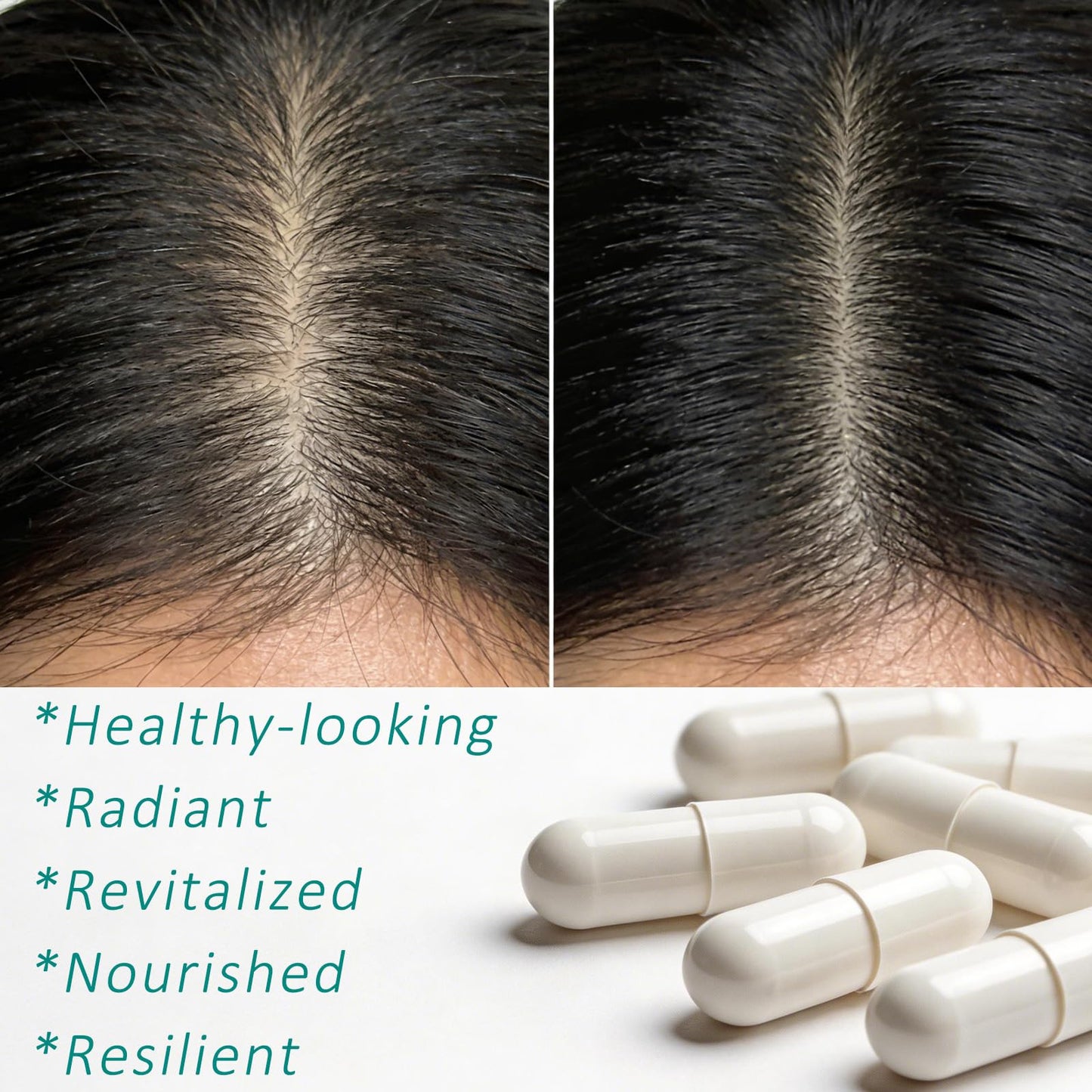 Hair Growth Biotin 10000mcg Supplement with Vitamins A C D E & Calcium - 30-in-1 Formula for Hair & Nails Support, for Women & Men, 30 Servings (1) - dailyvitalstore