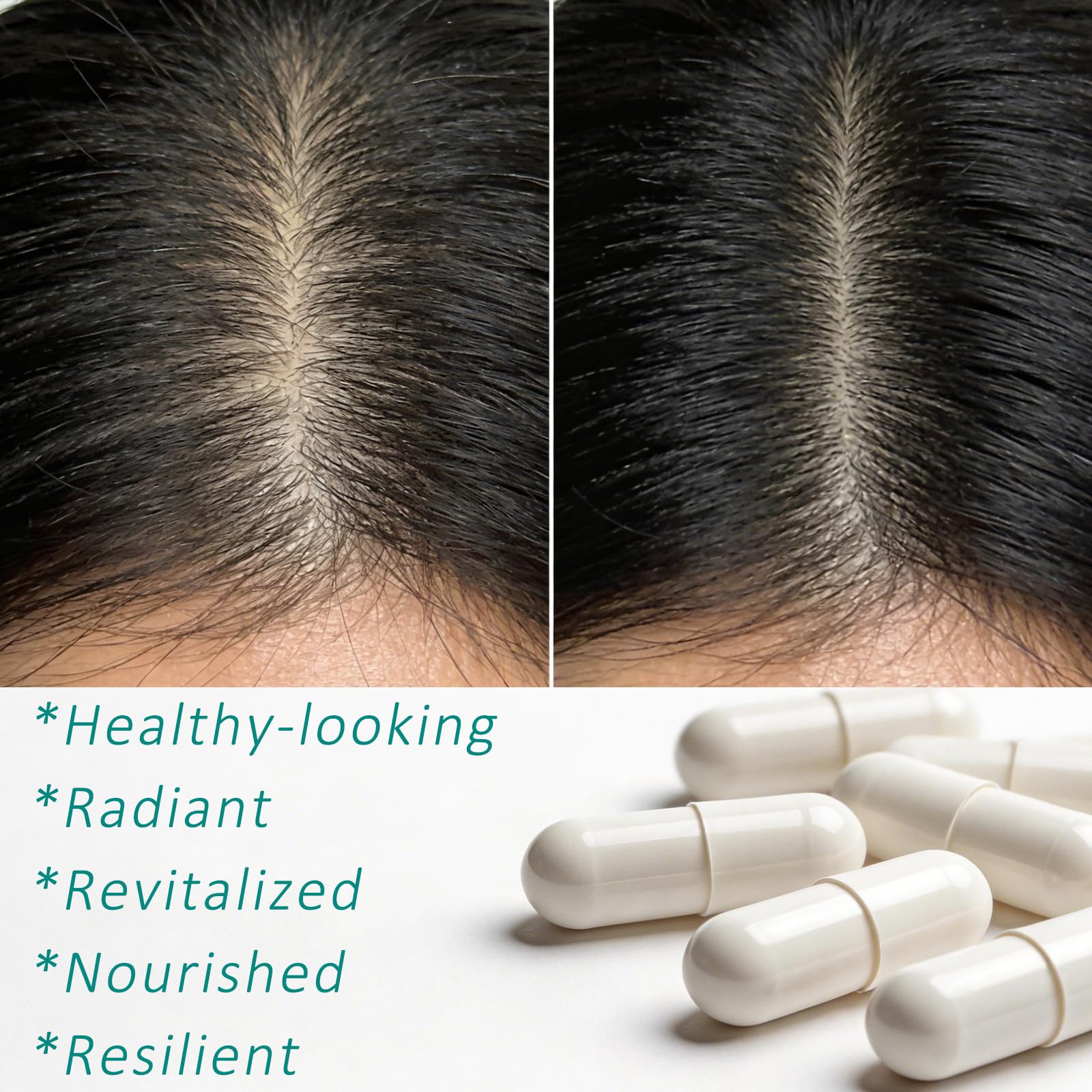 Hair Growth Biotin 10000mcg Supplement with Vitamins A C D E & Calcium - 30-in-1 Formula for Hair & Nails Support, for Women & Men, 30 Servings (1) - dailyvitalstore