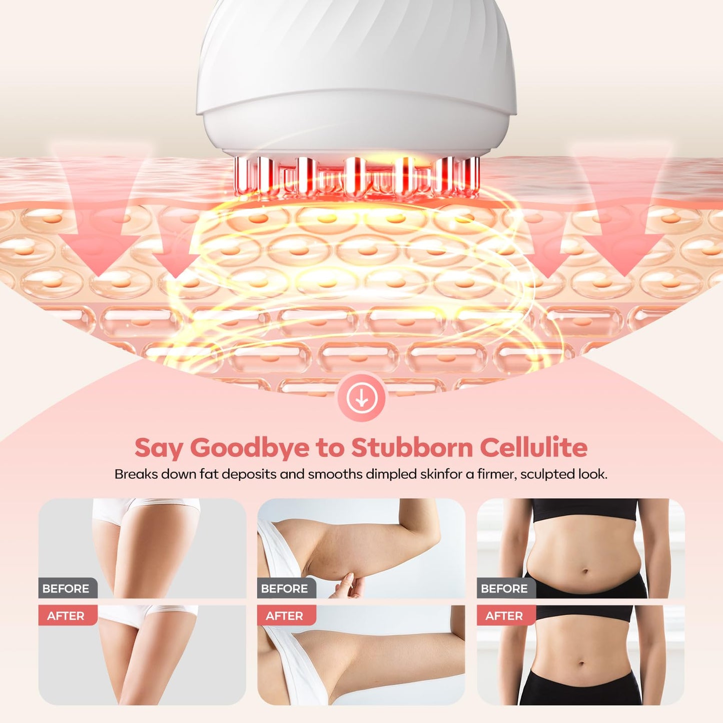 HarrFlow Lymphatic Drainage Massager & Anti Cellulite Massage Tool, Lymphatic Massager,Helps Reduce Stretch Marks & Cellulite，for Belly, Arms & Legs,Body Sculpting Machine with Heat & Vibration - dailyvitalstore