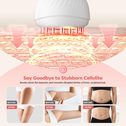 HarrFlow Lymphatic Drainage Massager & Anti Cellulite Massage Tool, Lymphatic Massager,Helps Reduce Stretch Marks & Cellulite，for Belly, Arms & Legs,Body Sculpting Machine with Heat & Vibration - dailyvitalstore