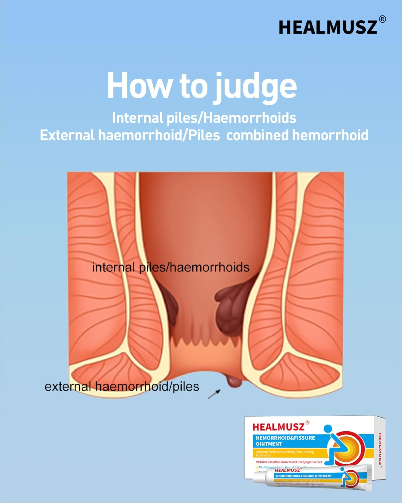 HEALMUSZ Hemorrhoid Fissure Ointment– Hemorrhoid Treatment and Hemorrhoid Cream with Lidocaine and Phenylephrine HCI for Fast Acting Relief of Pain, Swelling, Discomfort, and Itching(1.5 oz) - dailyvitalstore