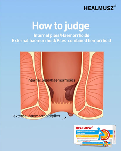 HEALMUSZ Hemorrhoid Fissure Ointment– Hemorrhoid Treatment and Hemorrhoid Cream with Lidocaine and Phenylephrine HCI for Fast Acting Relief of Pain, Swelling, Discomfort, and Itching(1.5 oz) - dailyvitalstore