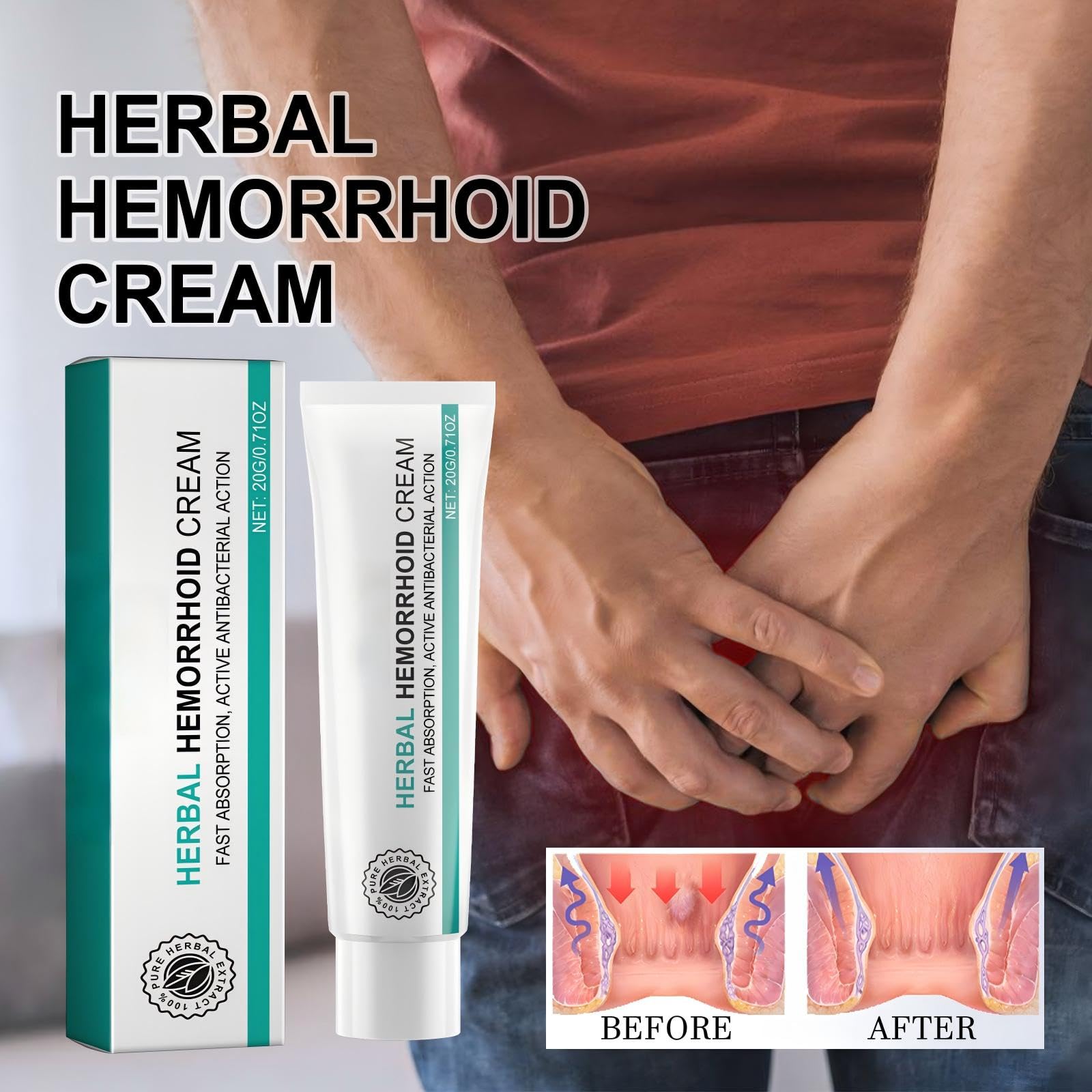 Hemorrhoid Cream, Herbal Hemorrhoid Ointment, Natural Itching & Burning Relief Hemorrhoidal Cream, External Discomfort Support for Men Women 20g - dailyvitalstore
