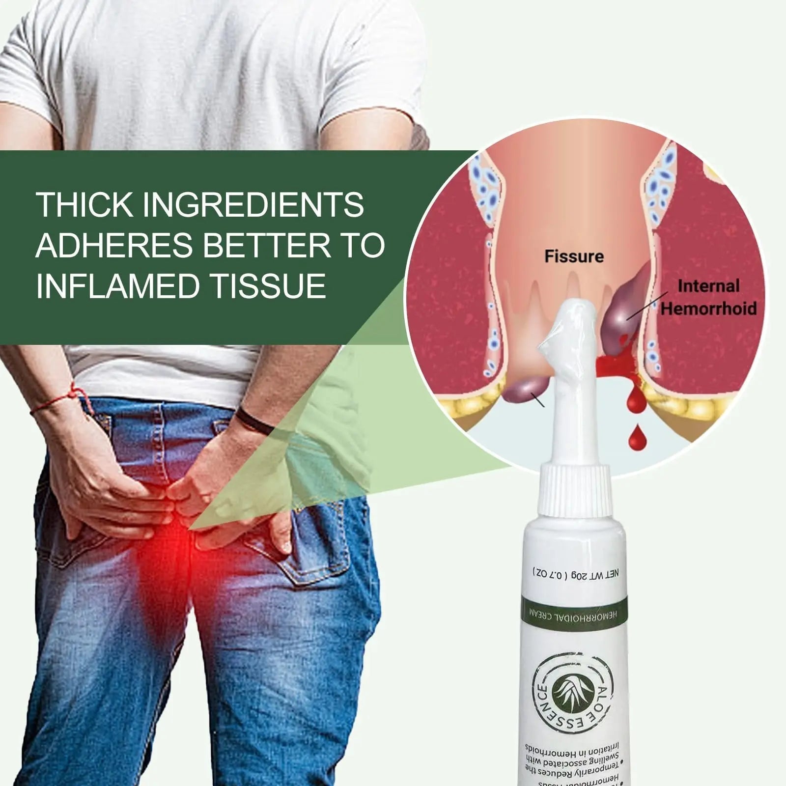 Hemorrhoid & Fissure Ointment, Hemorrhoid Treatment and Hemorrhoid Cream with Lidocaine 4% and Phenylephrine HCI for Fast Relief of Pain, Swelling, Itching, Burning, Hemorrhoidal treatment, 2 Pack-J2 - dailyvitalstore