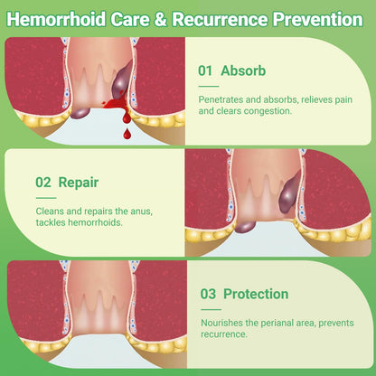 Hemorrhoid Treatment Ointment - Tubesmaximum Strength - Fast Relief from Pain, Itching, Burning, Swelling & Fissures | Natural Aloe & Vitamin E | Travel-Friendly10g x 5 Pieces Tubes - (1.76 Oz) - dailyvitalstore