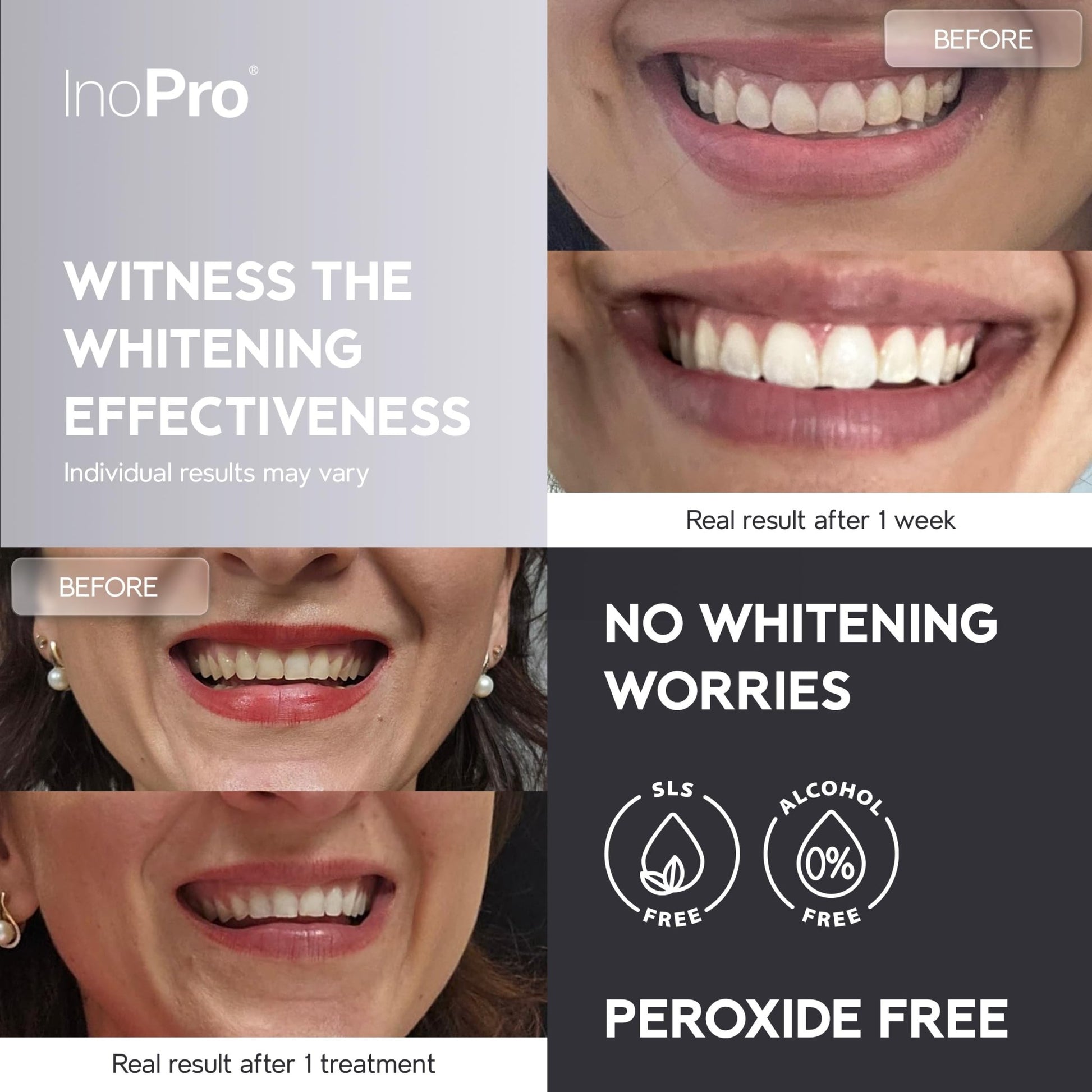 InoPro Natural Teeth Whitening Strips Kit 14 Treatments - Sensitive Teeth Whitener, Peroxide Free with Papain, Bromelain, Coconut Oil - dailyvitalstore