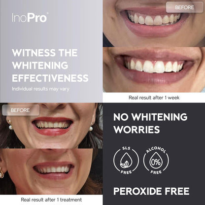 InoPro Natural Teeth Whitening Strips Kit 14 Treatments - Sensitive Teeth Whitener, Peroxide Free with Papain, Bromelain, Coconut Oil - dailyvitalstore