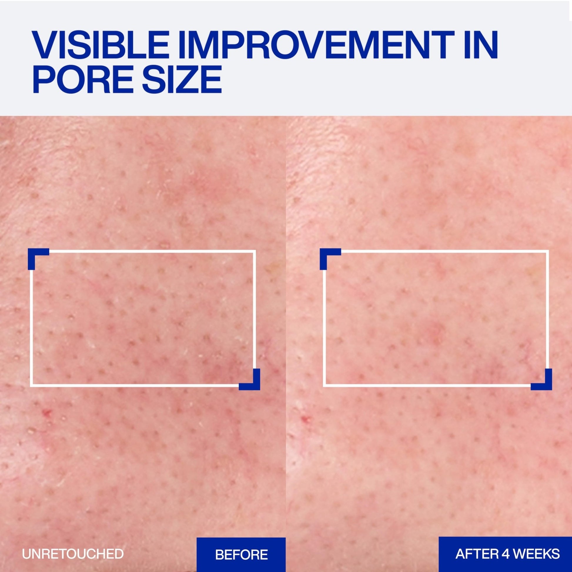 IOPE Expert Retinol RX 1% Super Bounce Serum - Gentle Anti-Aging Face Serum for Beginners - Visibly Firms Skin, Refines Pores, and Smooths Wrinkles - 1.01 fl. oz. - dailyvitalstore