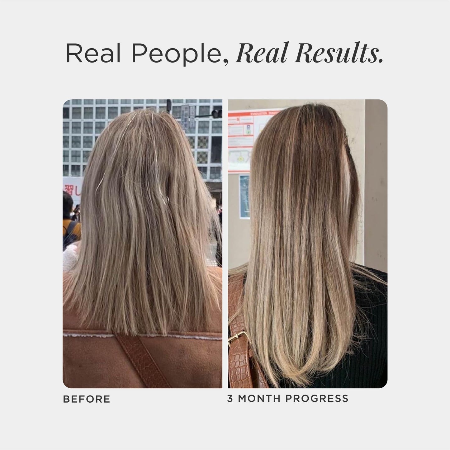 JSHealth Hair Growth Vitamins for Women. Hair + Energy with Kelp Iodine and Zinc. Supports Thickness, Strength, Energy. Nutritionist-Formulated (60 Capsules) - dailyvitalstore