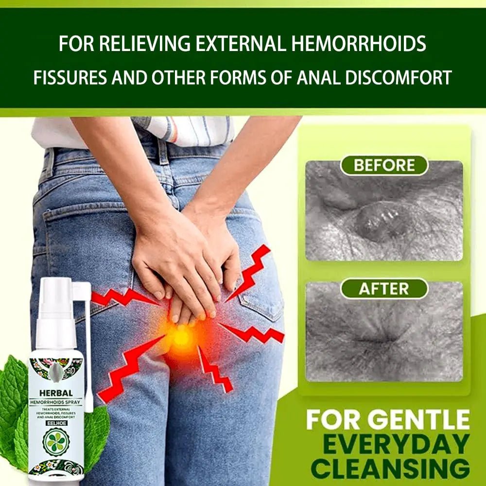 Juztec Hemorrhoid Treatment - Fast Relief with Hemocare Herbal Hemorrhoids Spray & Analese Numb Cream (1 PCS) - dailyvitalstore