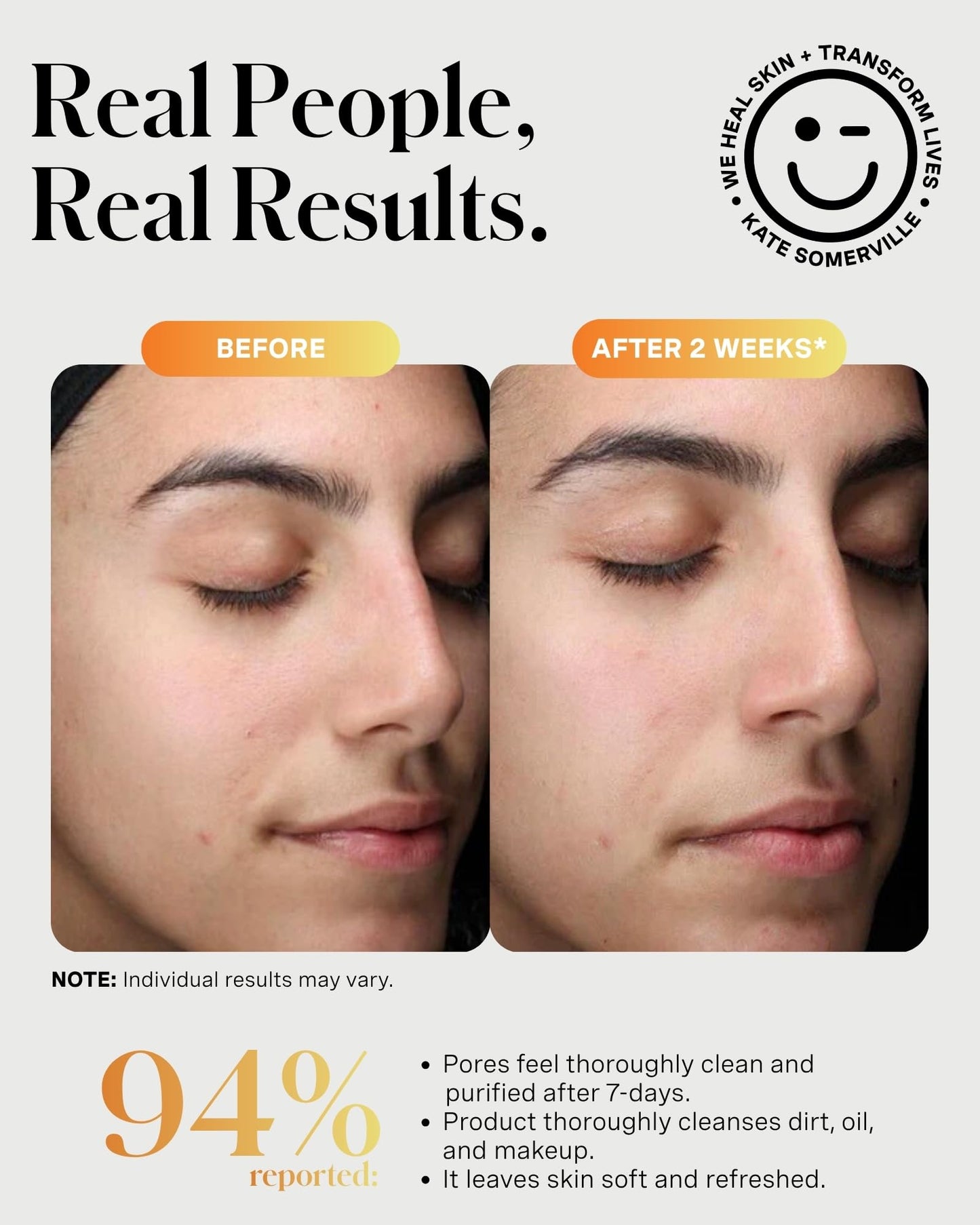 Kate Somerville ExfoliKate Cleanser – Daily Exfoliating Foaming Face Wash, Clinically Formulated Glycolic Acid and Lactic Acid Gentle - dailyvitalstore