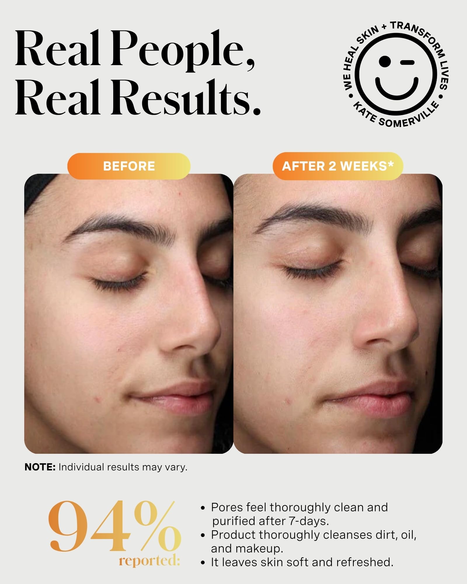 Kate Somerville ExfoliKate Cleanser – Daily Exfoliating Foaming Face Wash, Clinically Formulated Glycolic Acid and Lactic Acid Gentle - dailyvitalstore