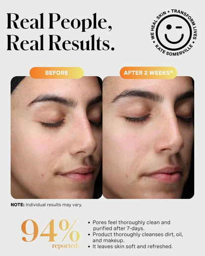 Kate Somerville ExfoliKate Cleanser – Daily Exfoliating Foaming Face Wash, Clinically Formulated Glycolic Acid and Lactic Acid Gentle - dailyvitalstore